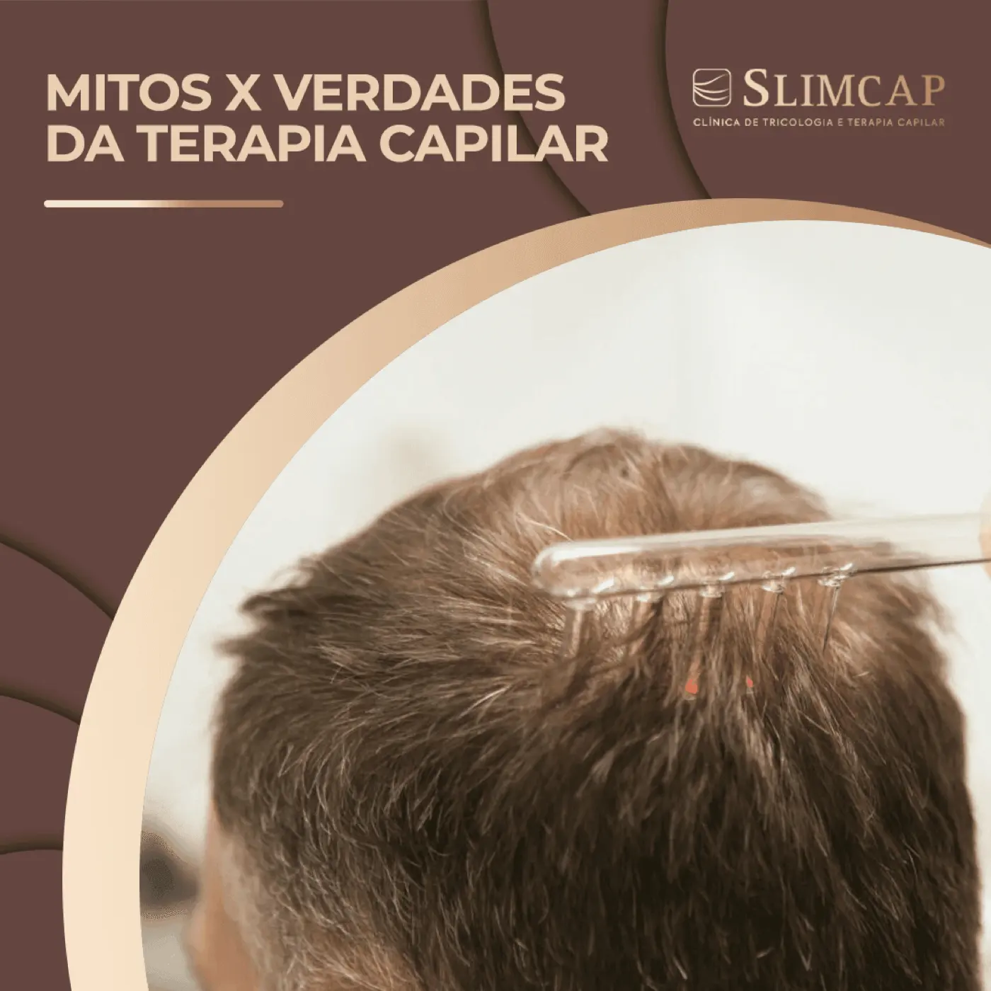 Mitos e Verdades sobre Terapia Capilar