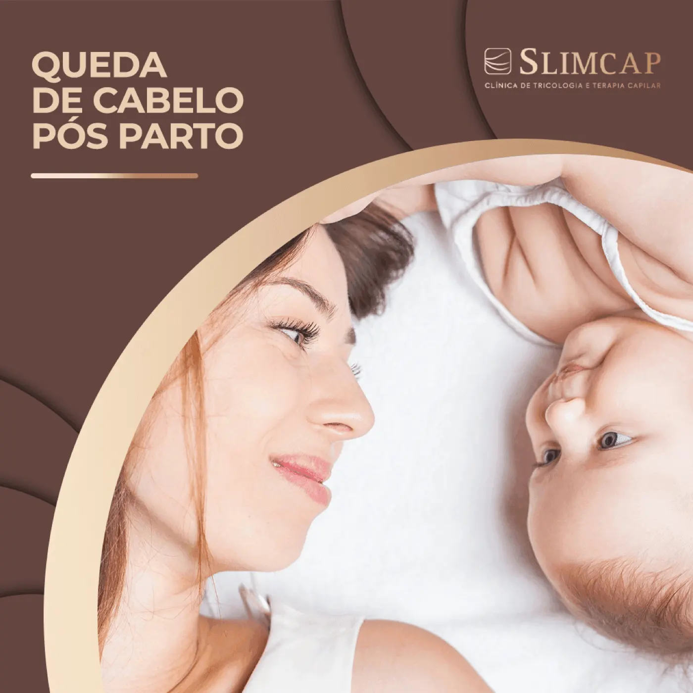 Queda de cabelo pós parto