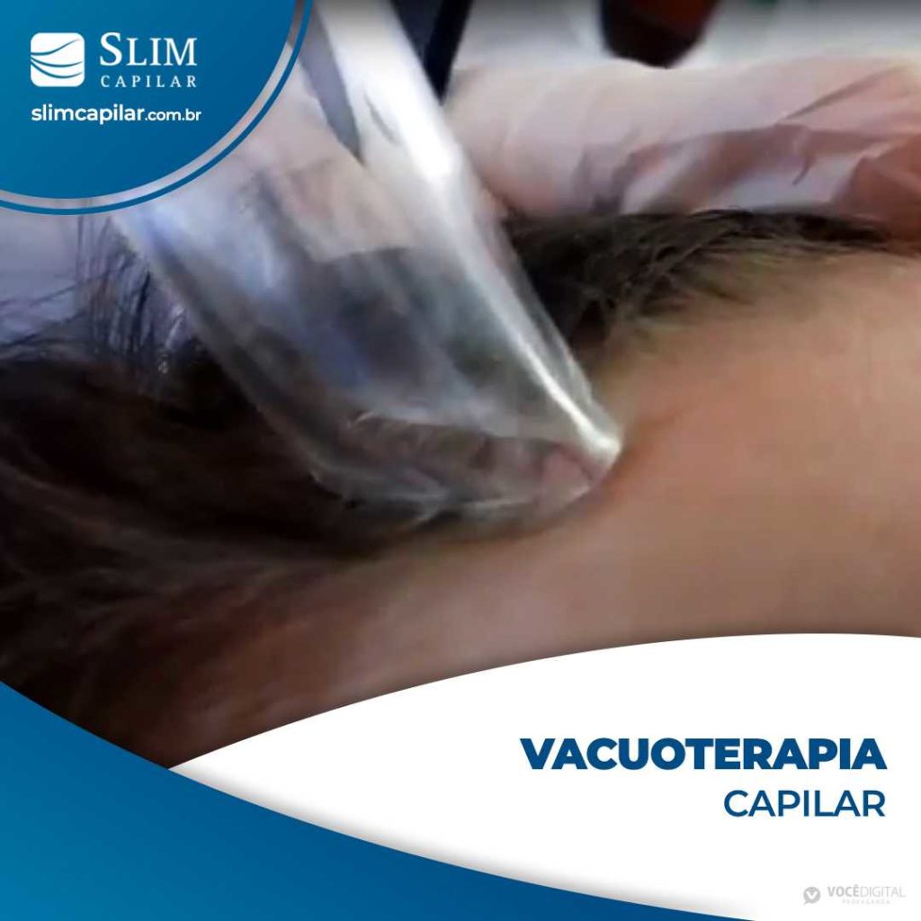 vacuoterapia