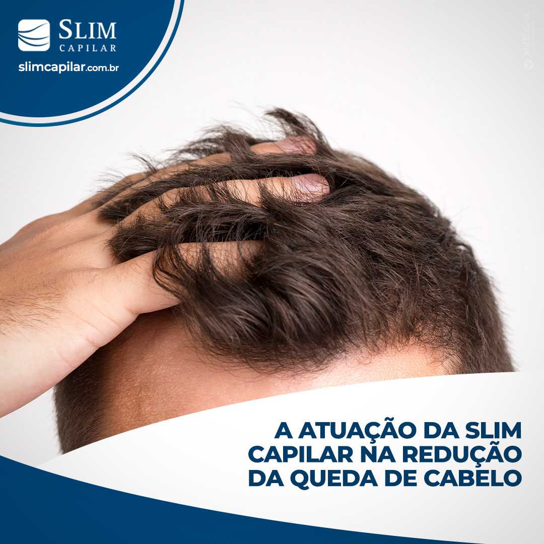 a atuação da slim capilar na redução da queda de cabelo